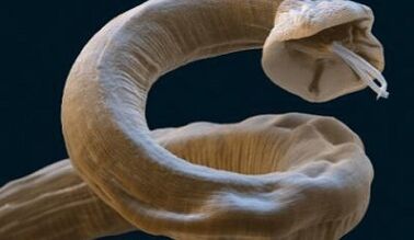 Ascaris Parasites in the Human Body