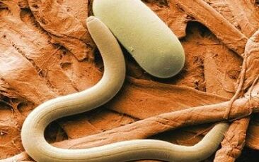 Types of parasites in the human body