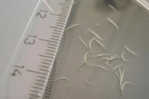 how to remove pinworms from children