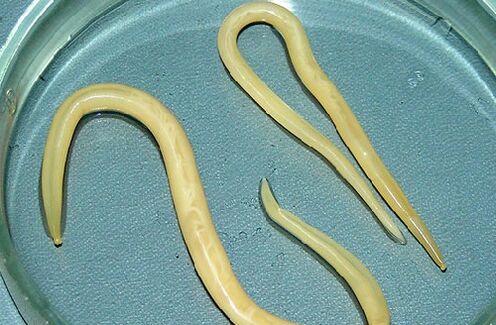 roundworm from a child's body