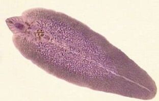 The causative agent of fascioliasis - Hepatic fluke