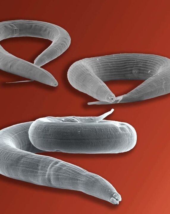 pinworm parasites that live in the gut