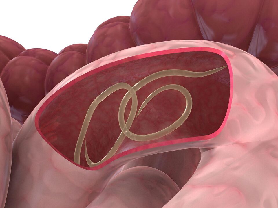 worms in the human intestine