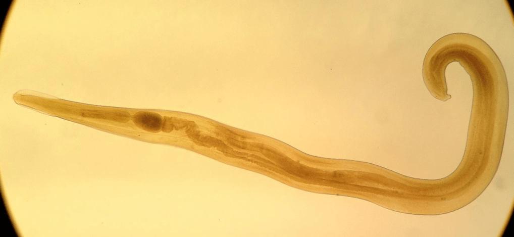 Pinworms are common parasites in children. 